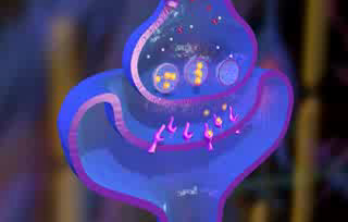 Maladie de Parkinson