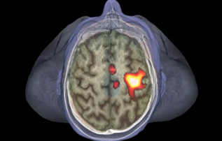 The brain fires up immune cells when sick people are nearby