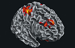 LREN - Laboratoire de recherche en neurosciences 