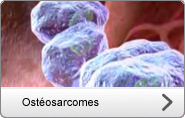 Ostéosarcomes
