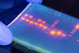 Recherche en cardiologie Recherche en cardiologie