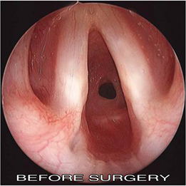 Photo d'avant la chirurgie Photo d'avant la chirurgie