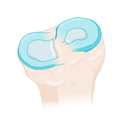 otr-genou-menisques_base